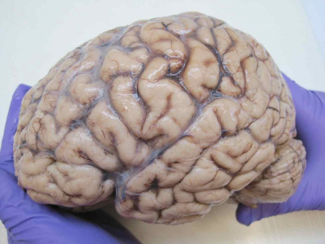 ludsky mozog
